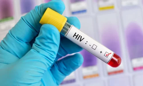 40 anos do primeiro caso de HIV AIDS no Brasil