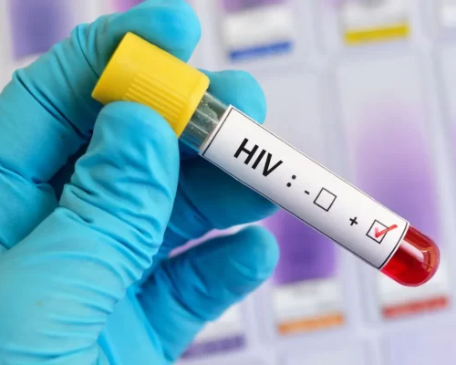 40 anos do primeiro caso de HIV AIDS no Brasil