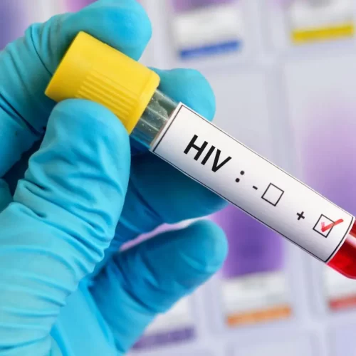 40 anos do primeiro caso de HIV AIDS no Brasil